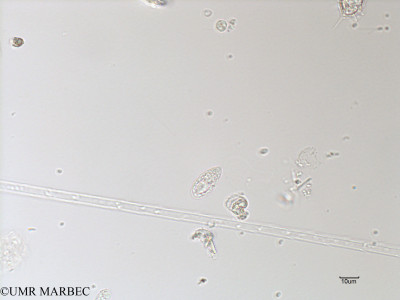 phyto/French_Polynesia/Arutua/ECOPE Janvier 2017/Achradina pulchra (C1A_S2R2_050117-3).tif(copy)_thumb.jpg